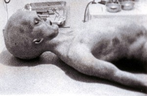 Una imagen de una autopsia al supuesto alienígena que se estrelló en Roswell. En 2006, Ray Santilli reconoció que el vídeo era un montaje basado en lo que vió en 1992 (aunque siguió defendiendo que la historia era real)